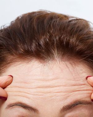 Fine Lines & Wrinkles